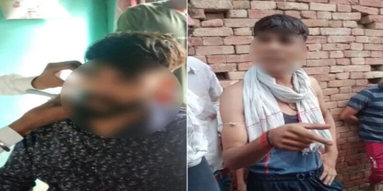 Saharanpur Rajputs forcibly cut Dalit youth beard mustache said how can you match us